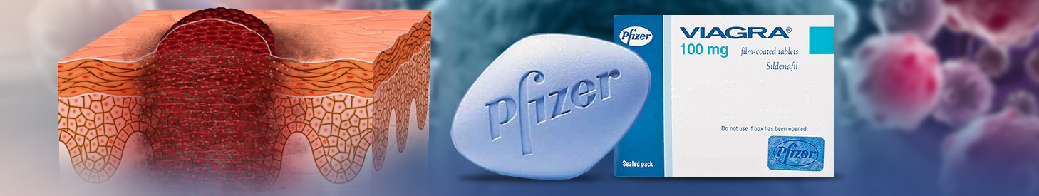 Viagra Norvasc Drug Interaction